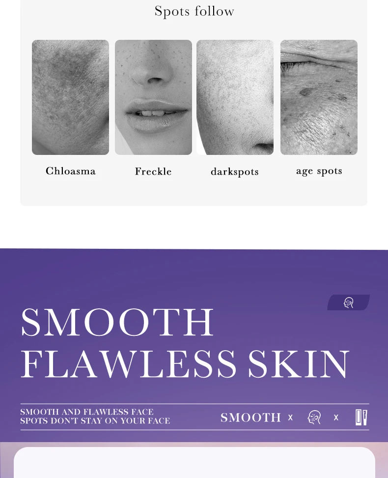 Freckle Removing Cream